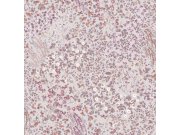 Vliesová tapeta na zeď, růžová, květiny, 142357, Allurium, Graham Brown Premium Tapety Yara - Graham & Brown Premium